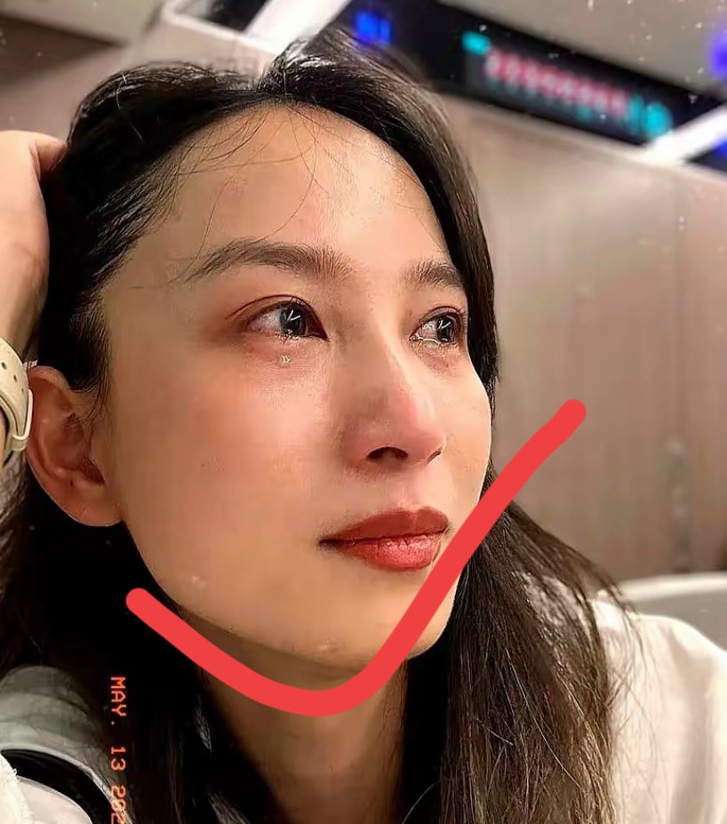 从侧面看下巴往前翘看着侧面非常不好看而且说话时候脸