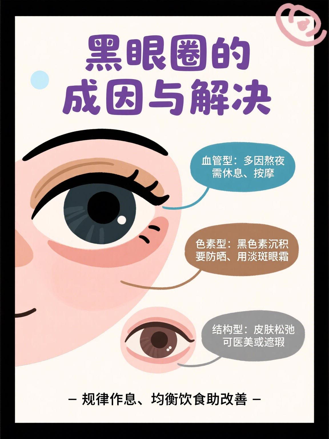 黑眼圈重什么原因