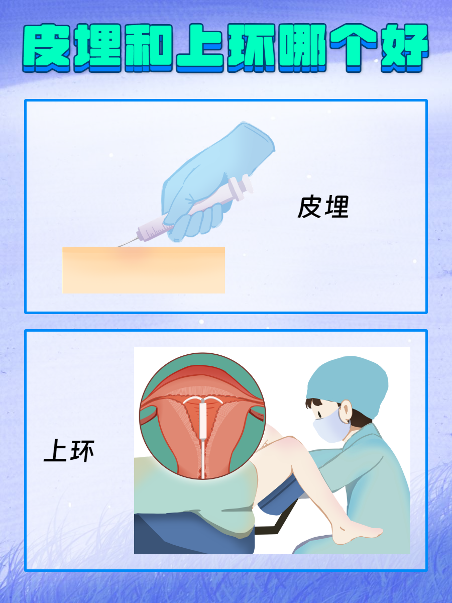 带避孕环的过程