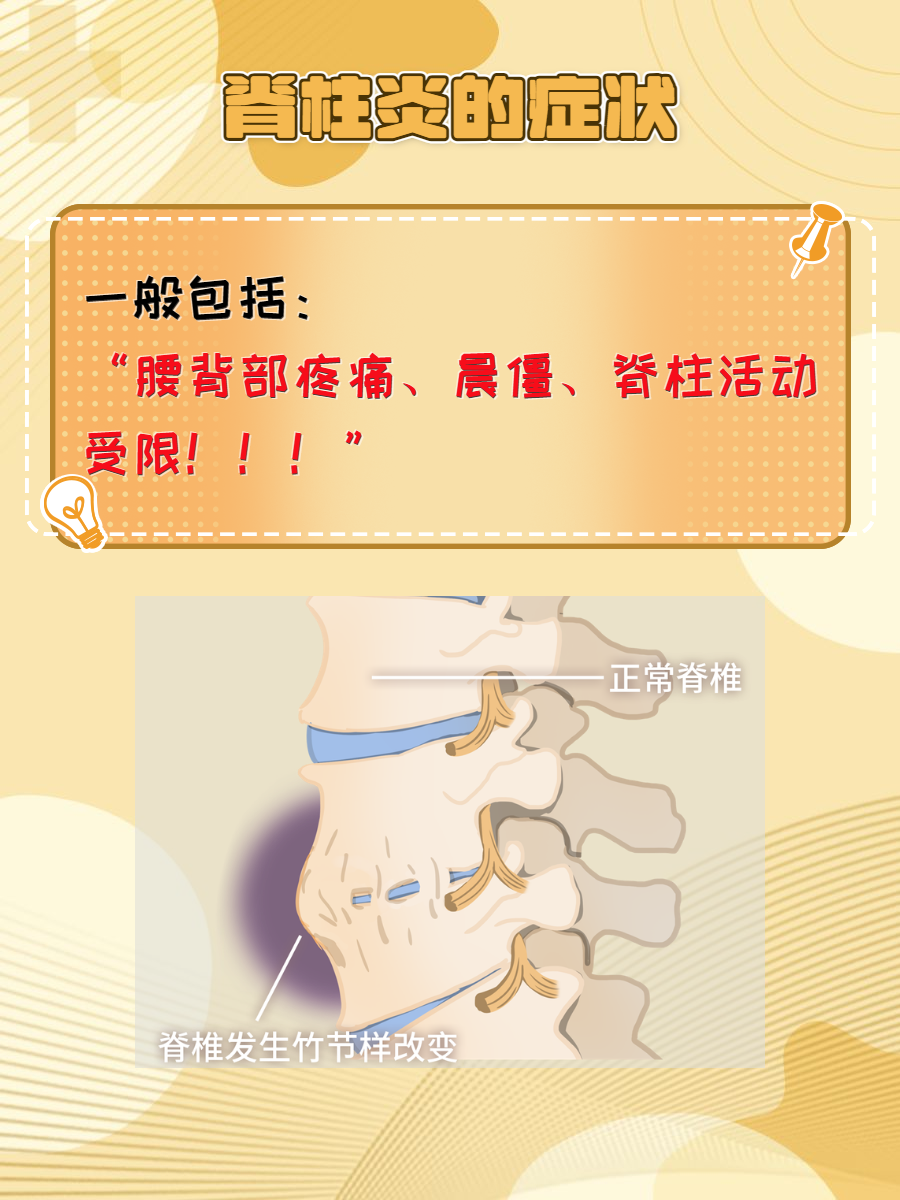 脊柱疼是什么原因