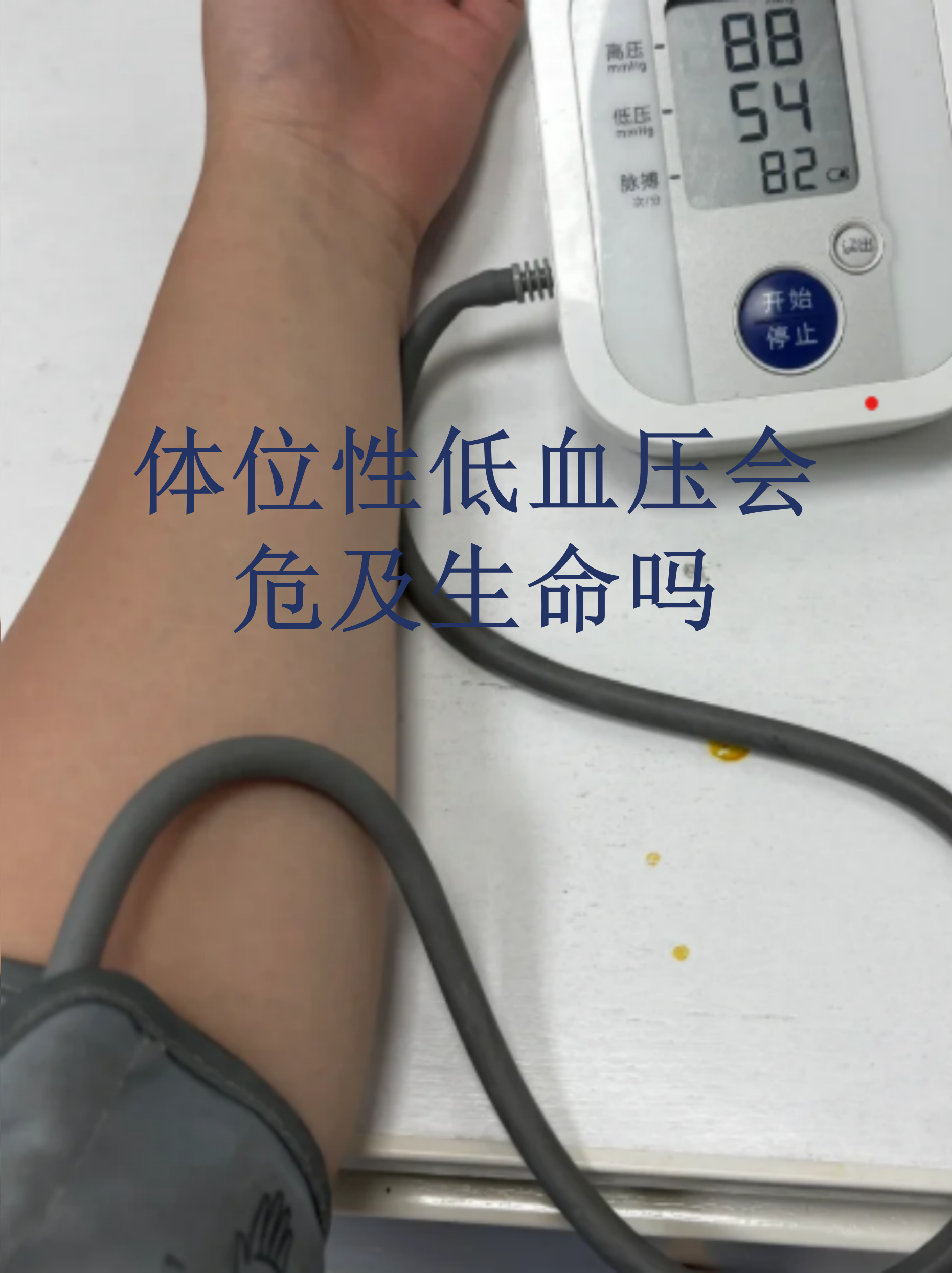 低血压是贫血吗