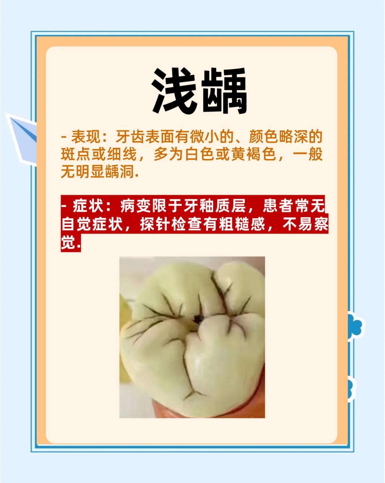 龋齿是什么意思