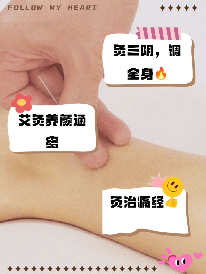 艾灸三交阴的禁忌有哪些