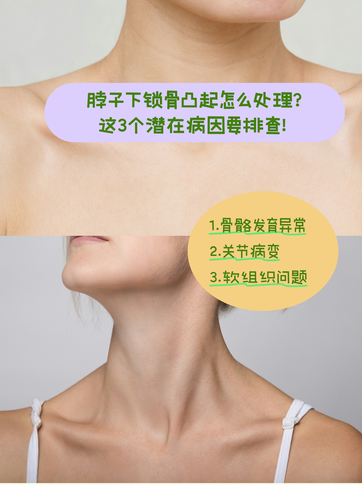 为啥脖子后面骨头突出?