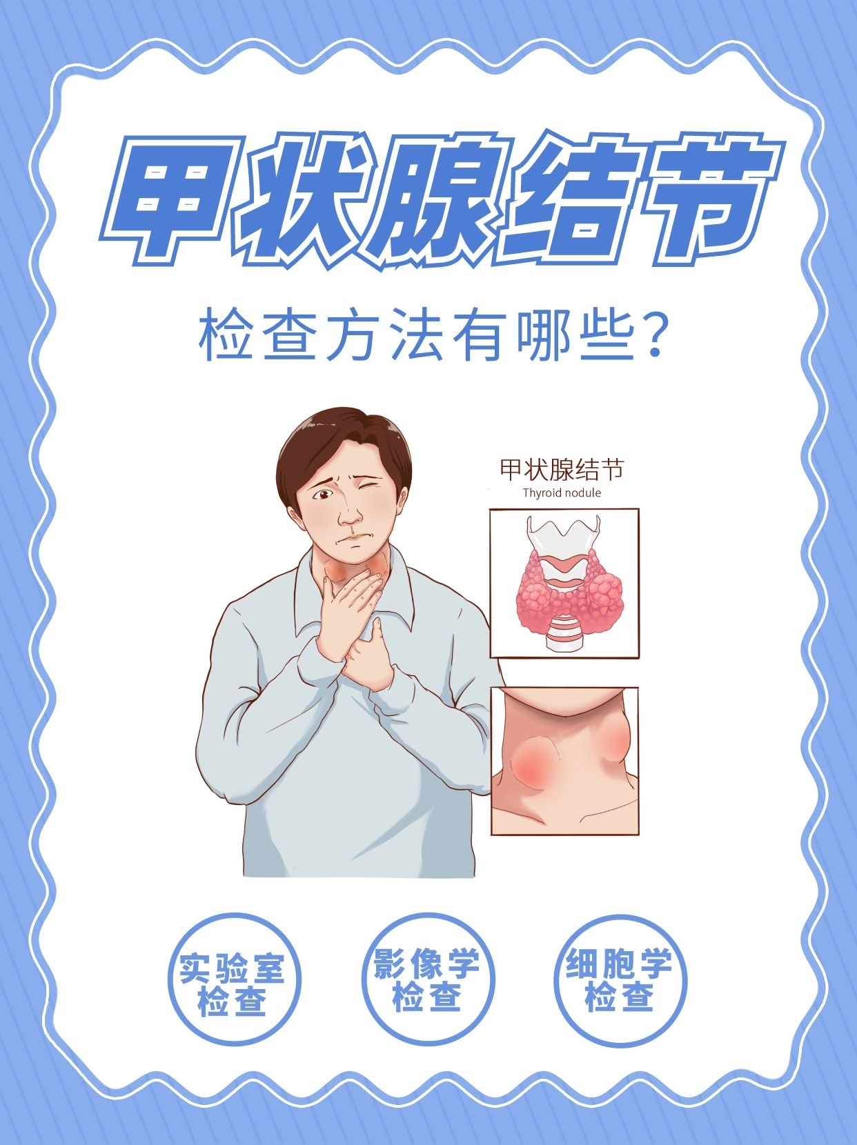 甲状腺结节挂什么科