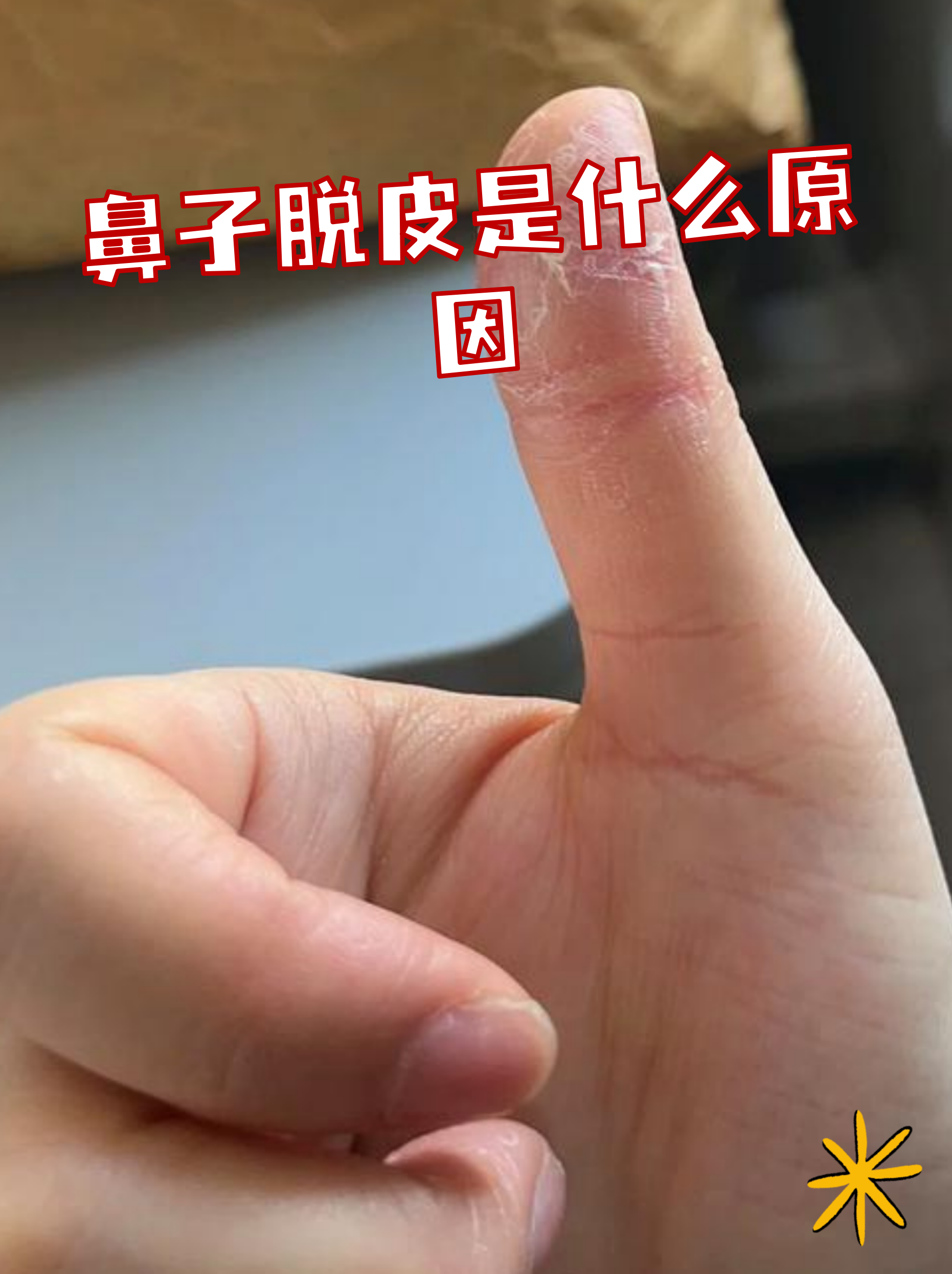 秋冬鼻子干燥怎么办