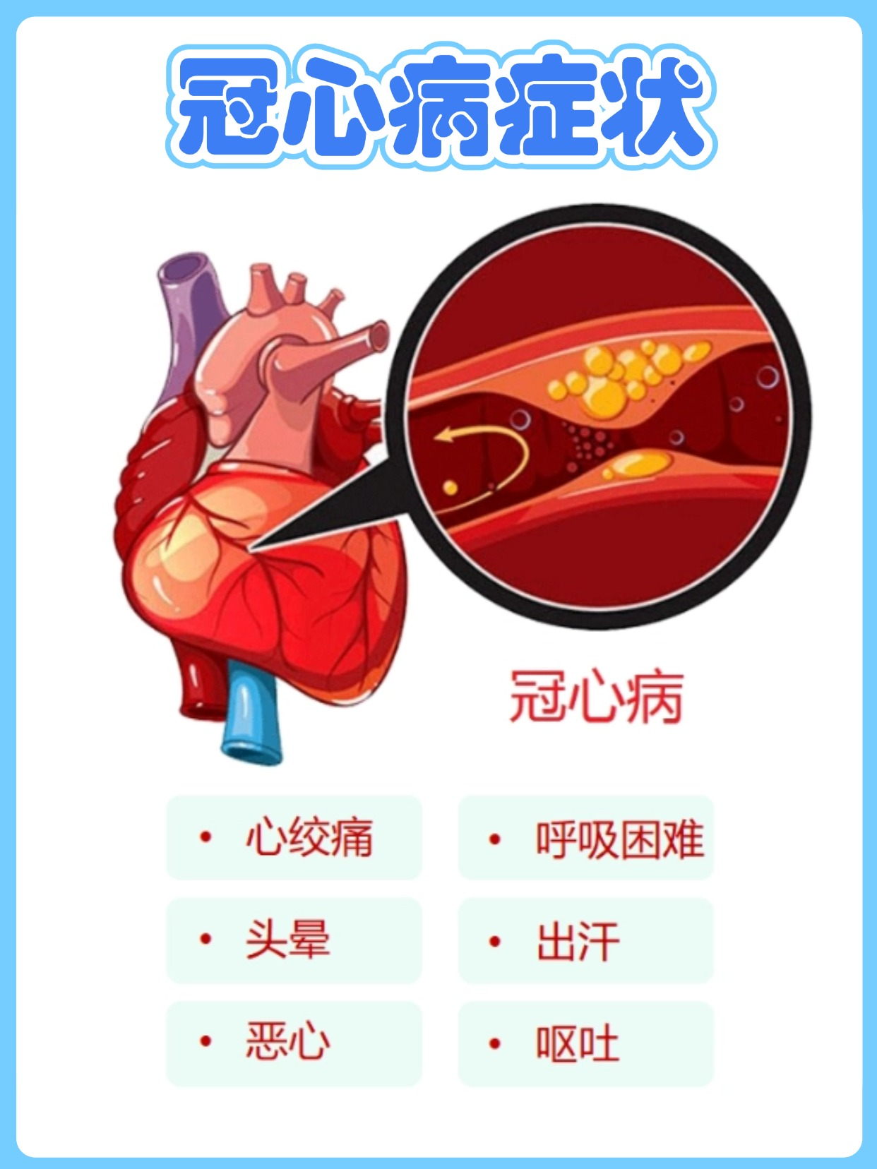 心绞痛会导致死亡吗?