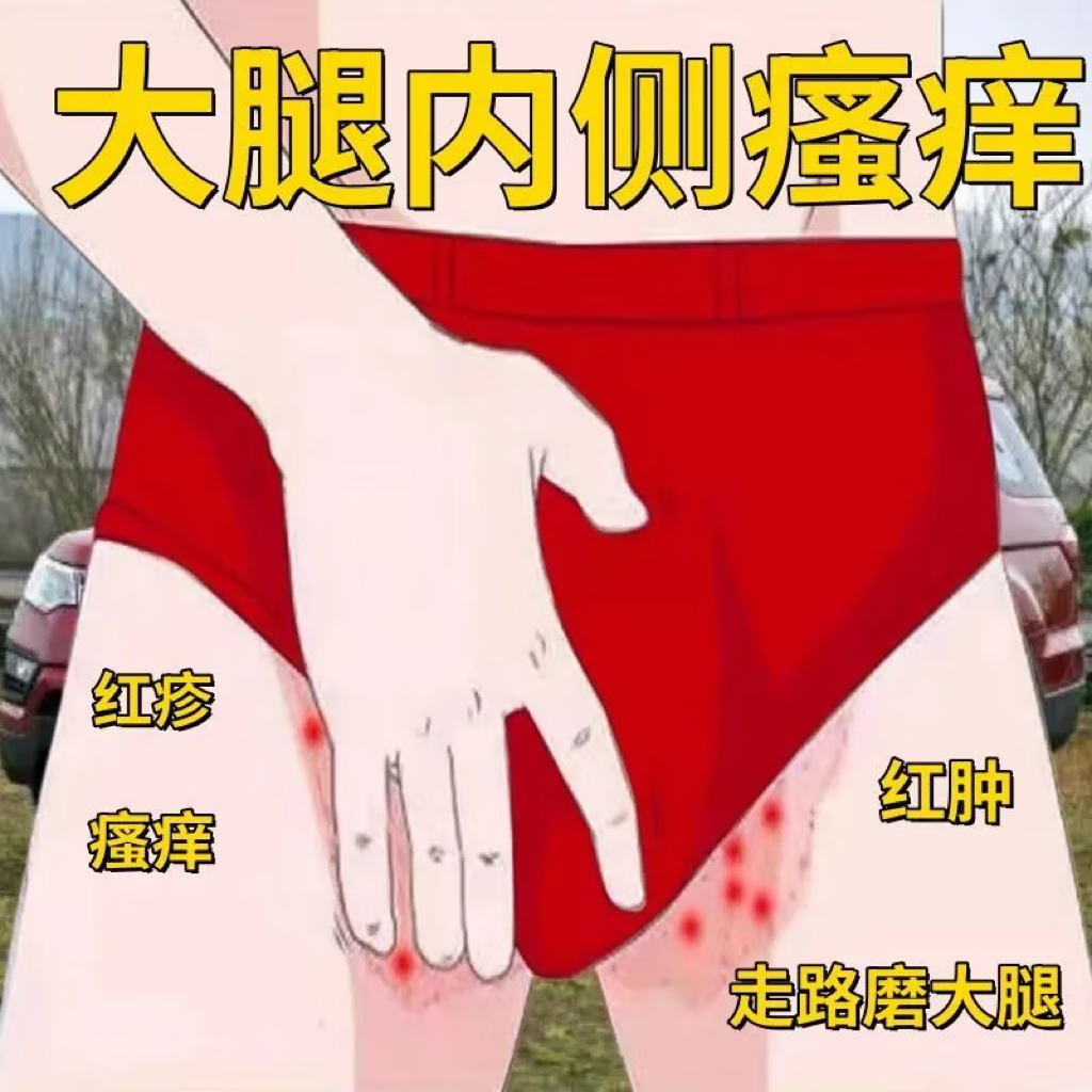 大腿内侧痒,越挠越痒