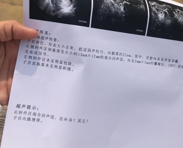 宫外孕早期hcg会翻倍吗