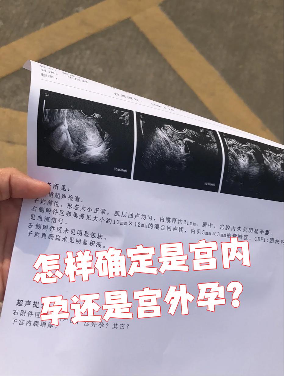 宫外孕早期hcg会翻倍吗