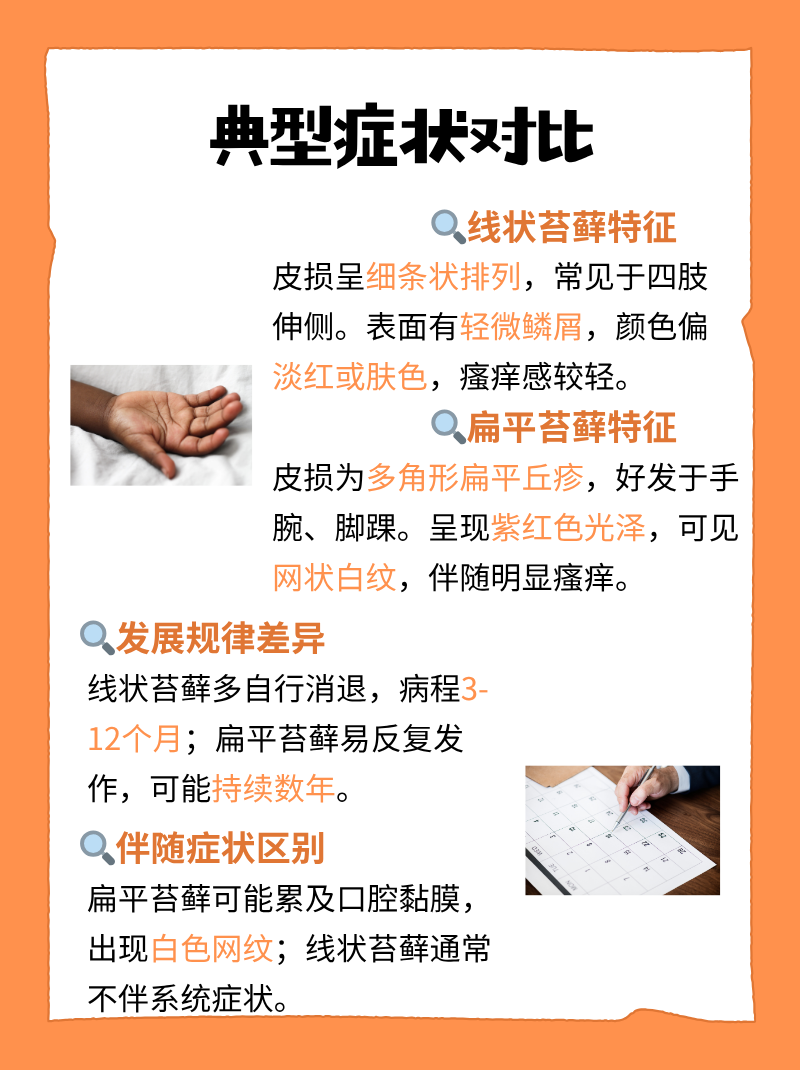 线状苔藓的具体表现及治疗