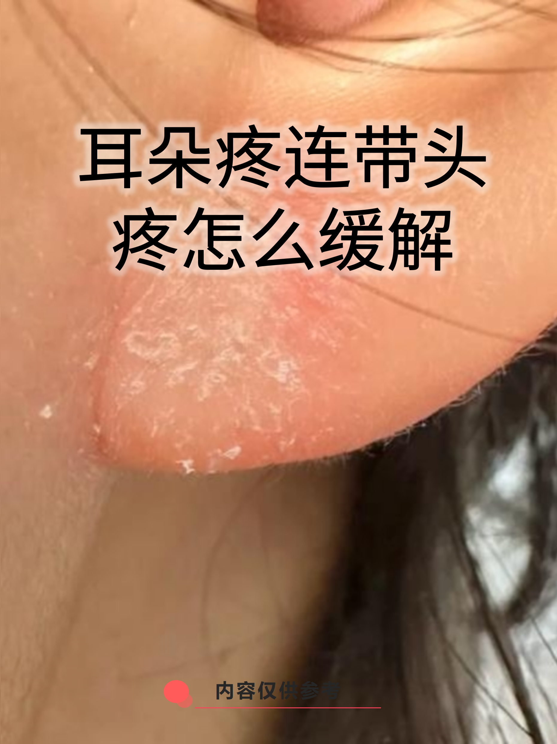 右耳朵痛是怎么回事