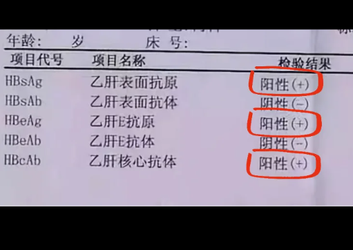 什么是乙肝表面抗原阳性