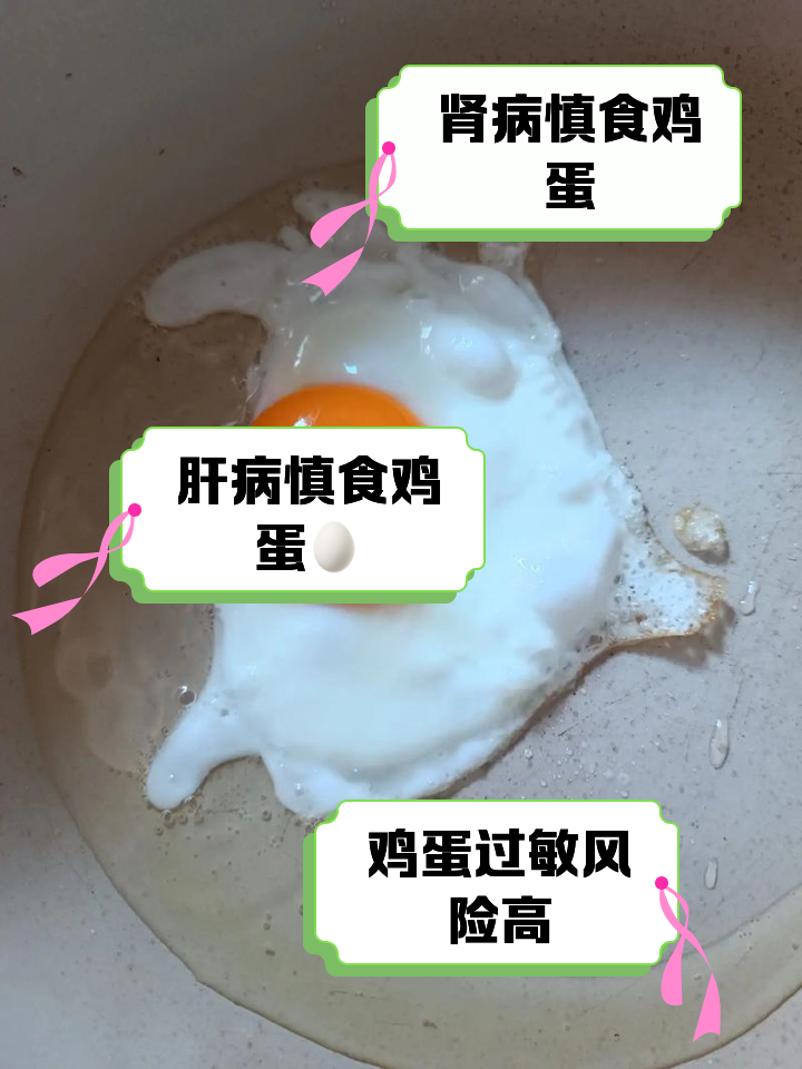 荨麻疹可以吃鸡蛋吗?