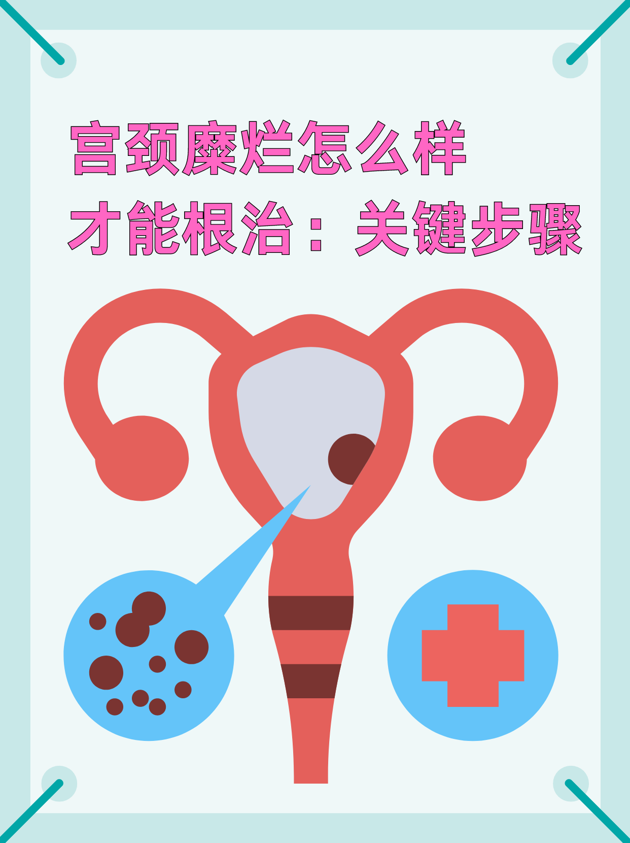 宫颈糜烂如何治疗?