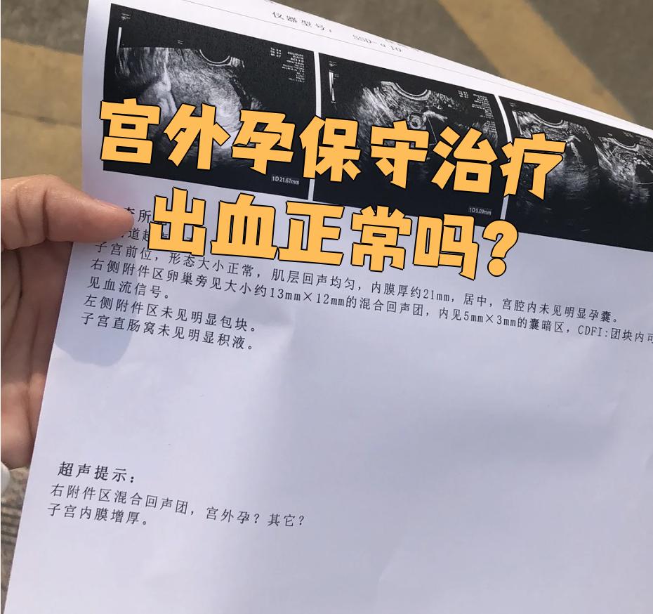 宫外孕一直出血吗