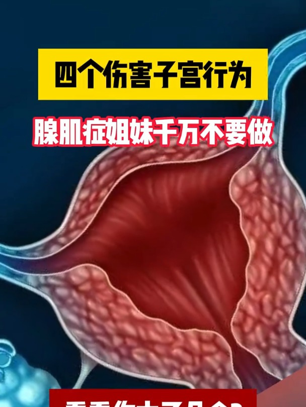 子宫肌腺症有哪些症状