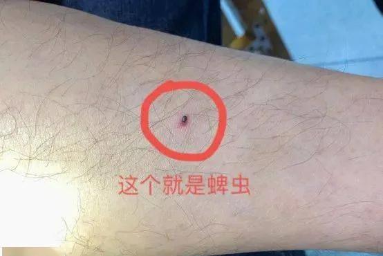 蜱虫有多么大,什么样子