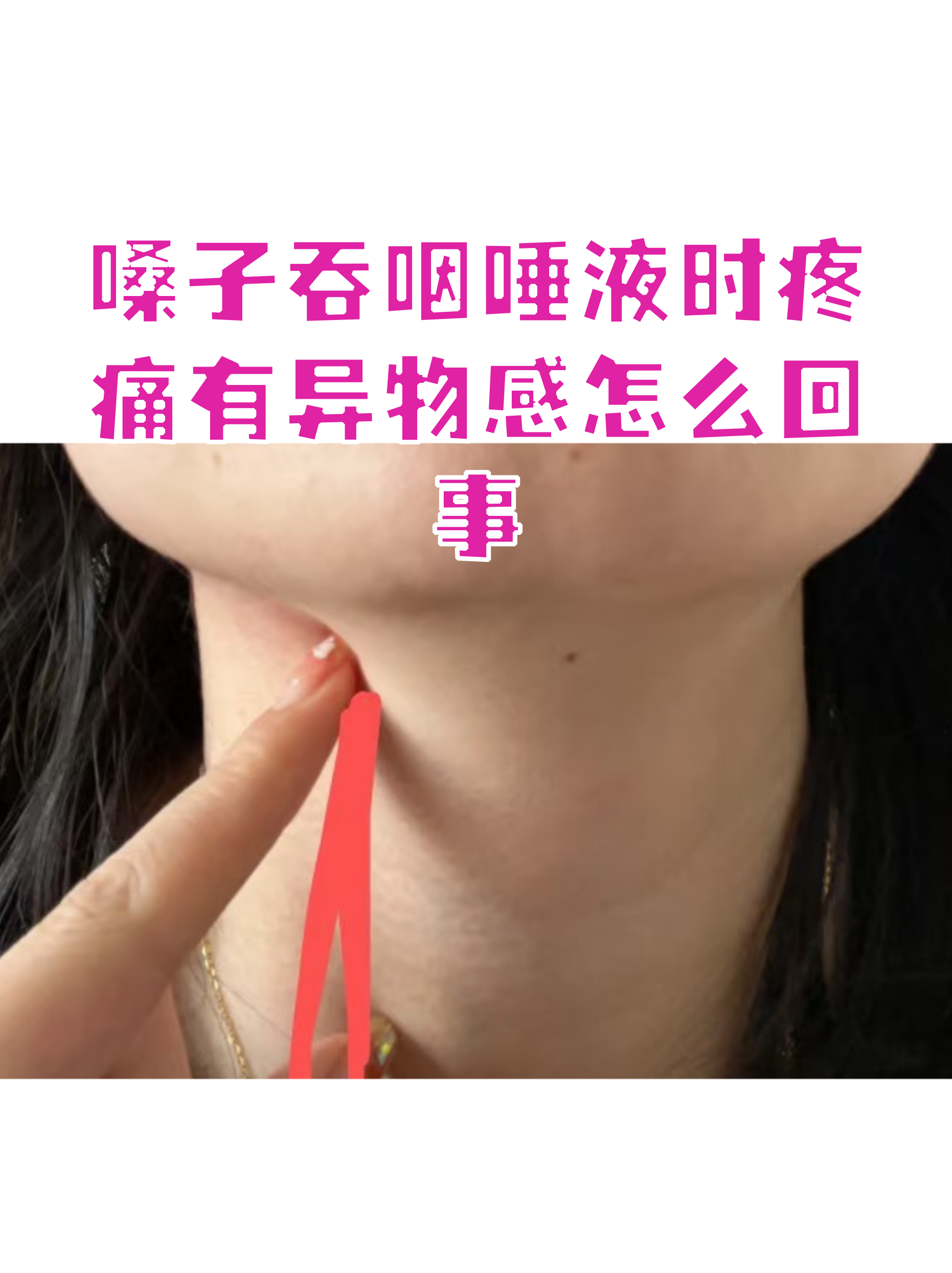 嗓子不舒服,吞咽有异物感