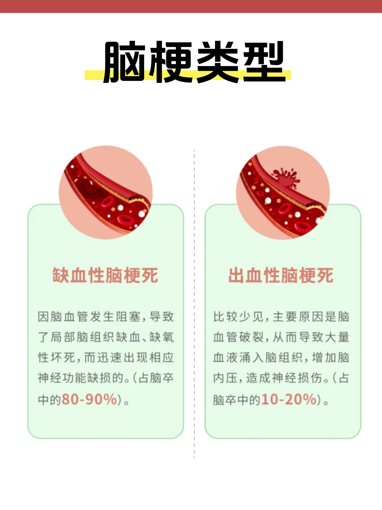 小脑梗塞的表现