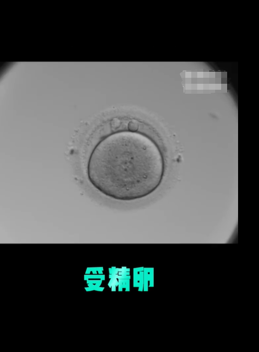 受精卵着床有什么感觉