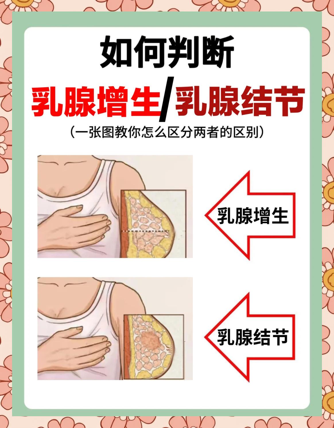 乳腺结节4a类是啥意思