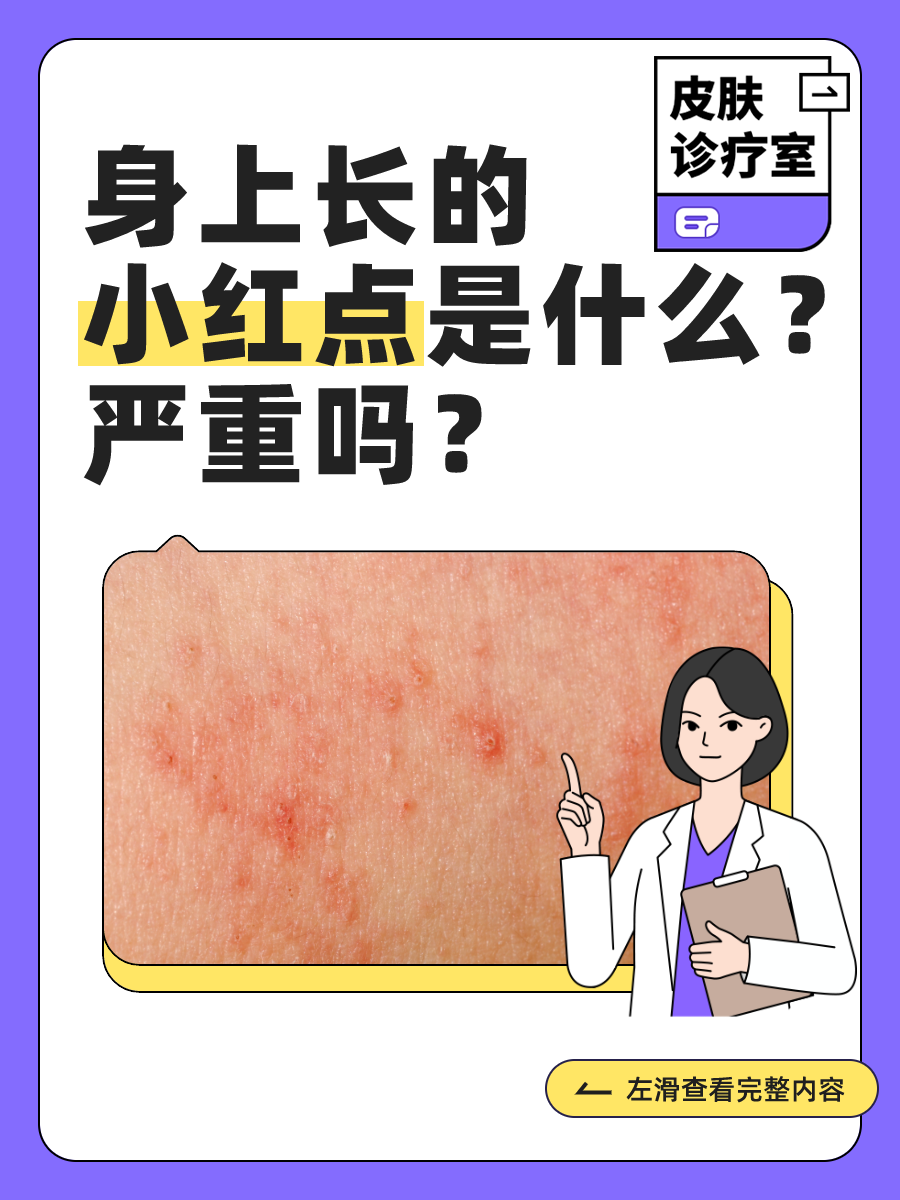 身上起红血点是什么原因