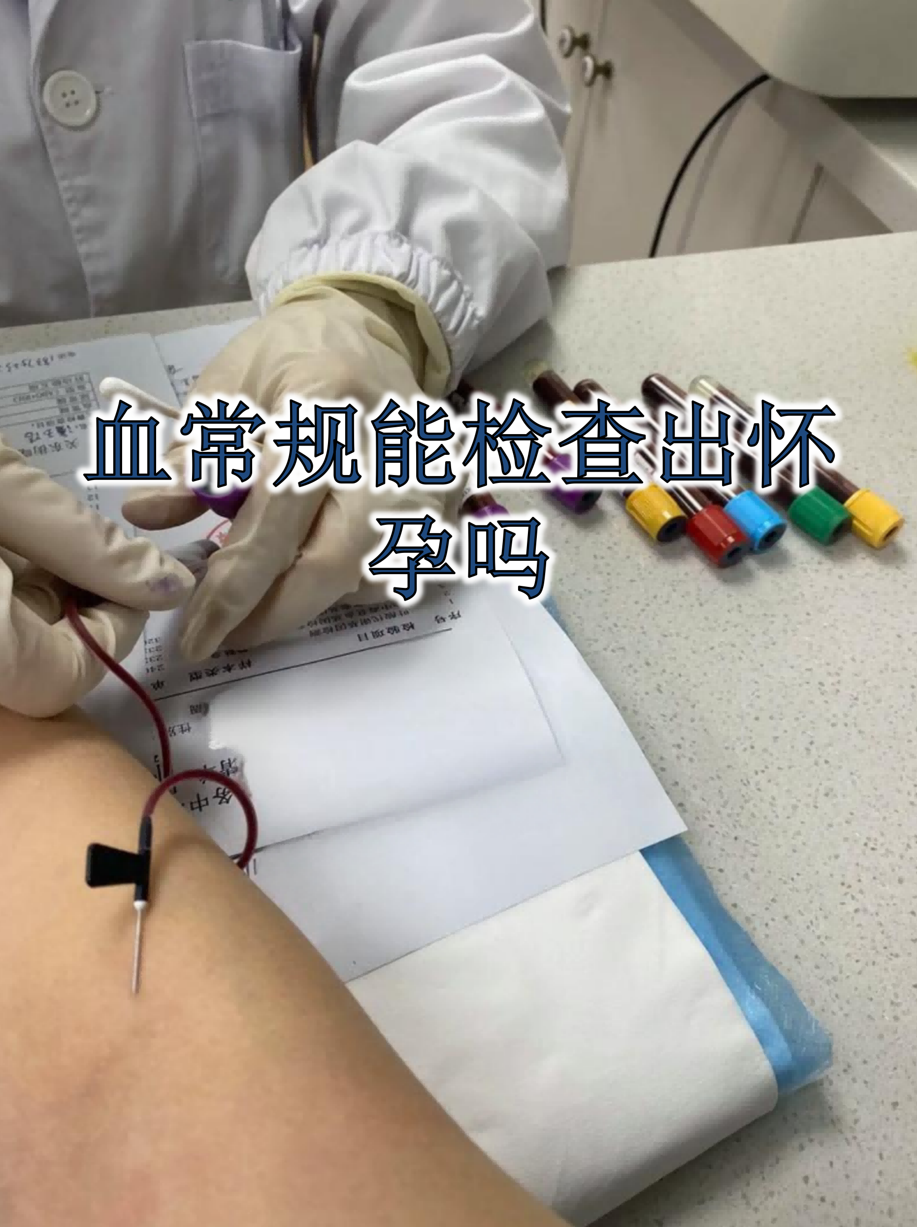 孕妇血常规白细胞高是什么原因