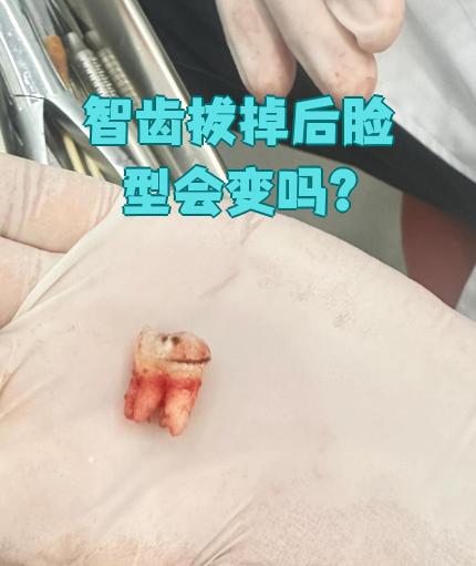 长智齿脸会变大吗