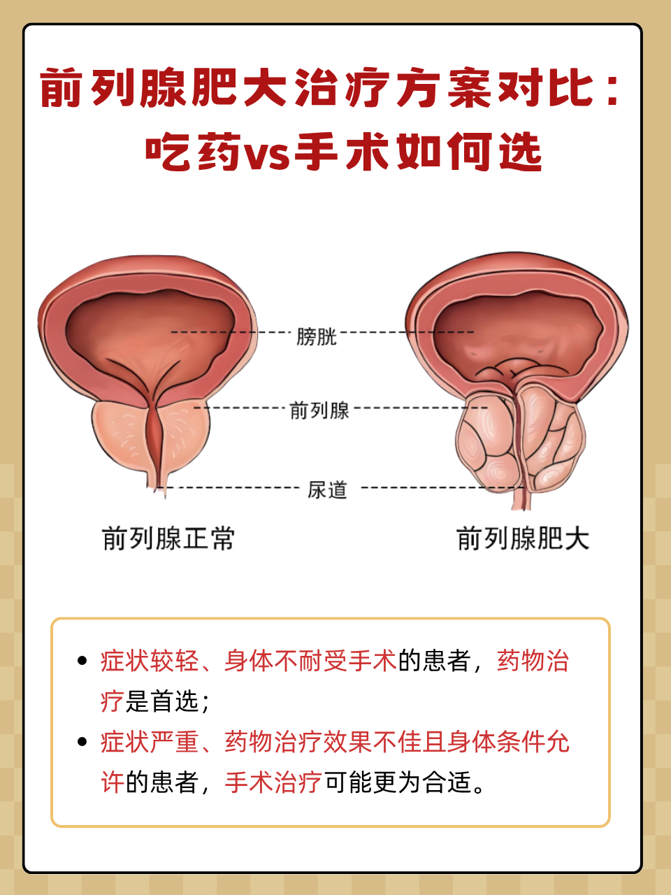前列腺肥大如何治疗