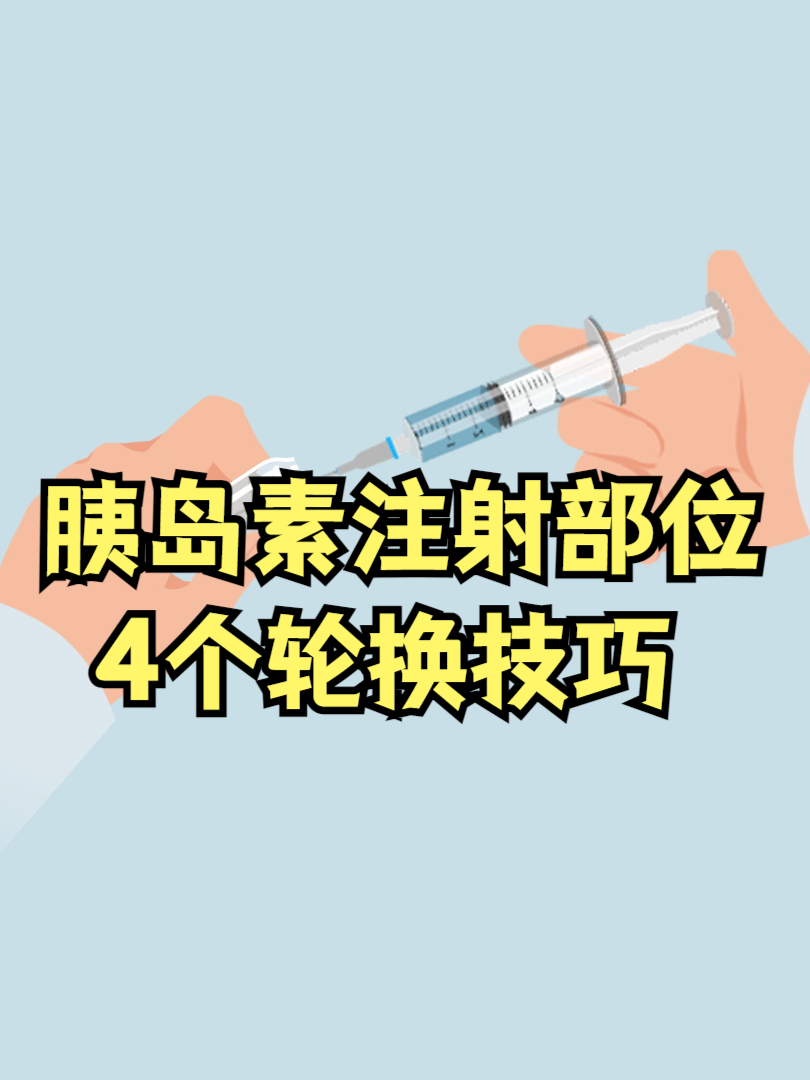 胰岛素注射部位如何轮换