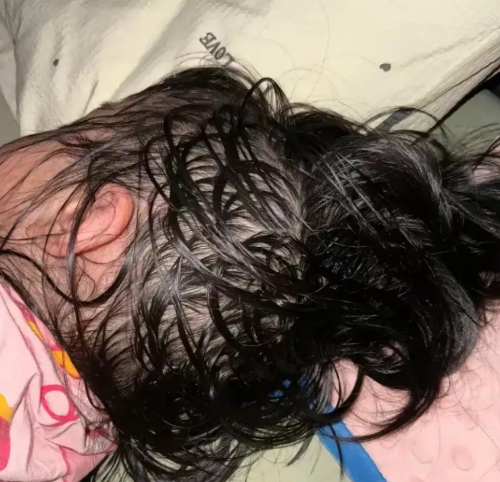 头上出汗多是怎么回事