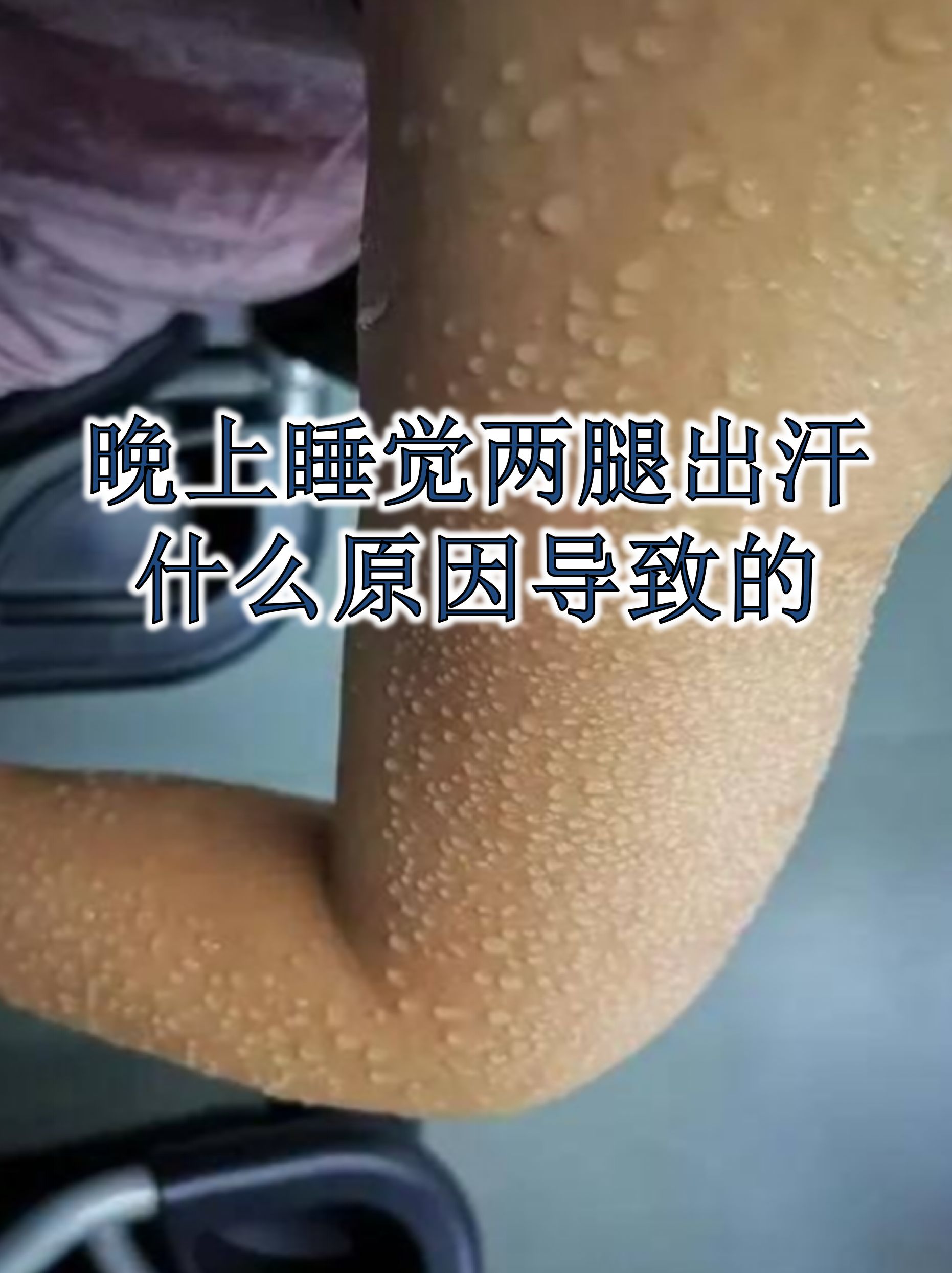 晚上睡觉大腿抖动是怎么回事