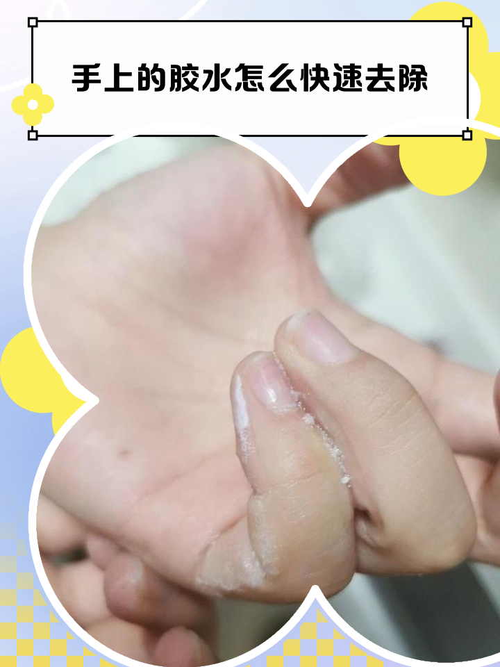 手茧怎么去除?