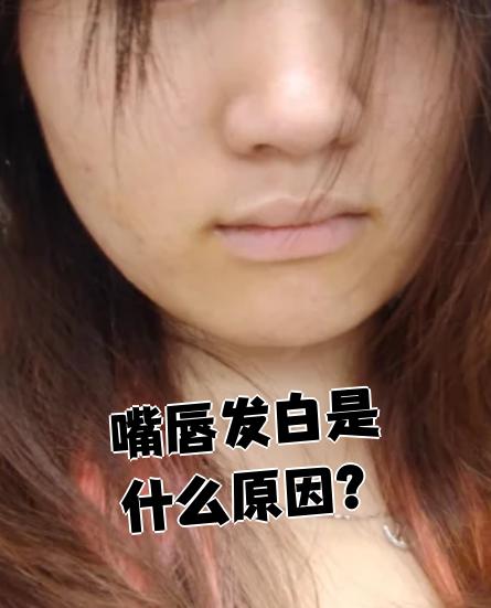 婴儿嘴唇发白是什么原因?