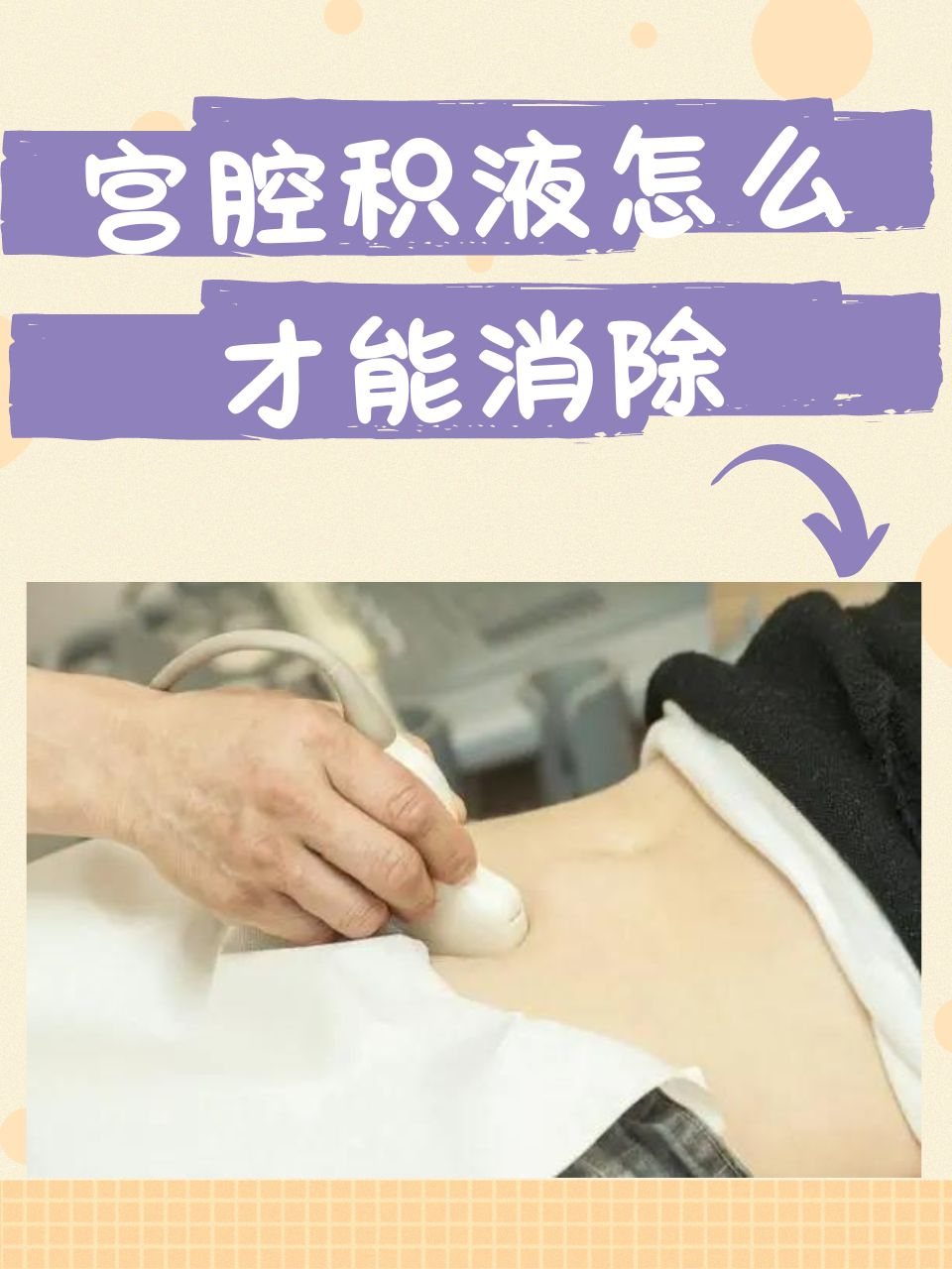怀孕宫内积液怎么消除