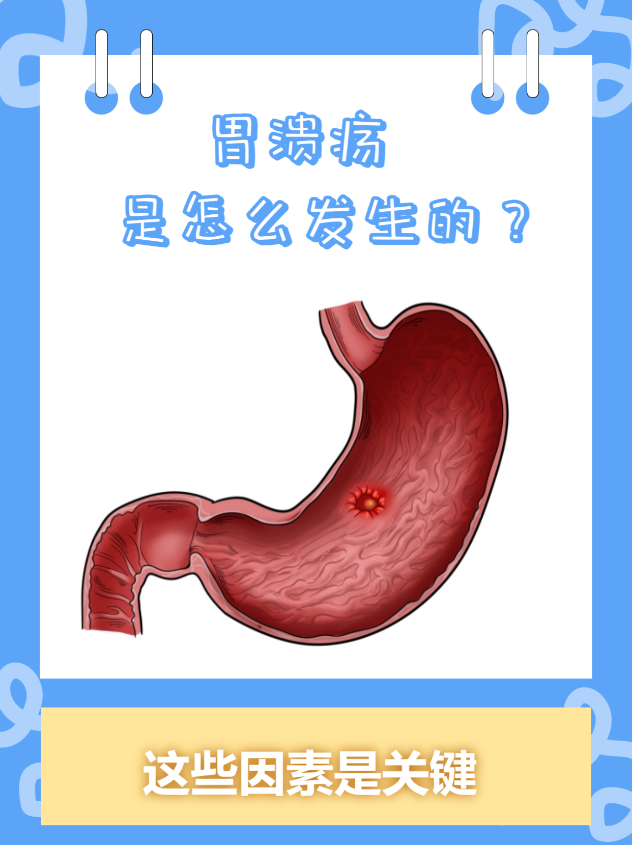 胃溃疡的好发部位?..