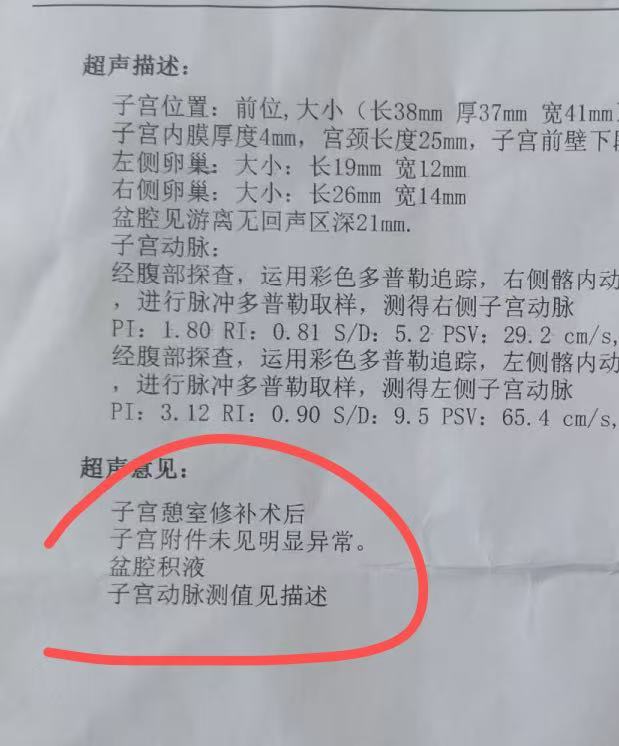 子宫憩室的症状