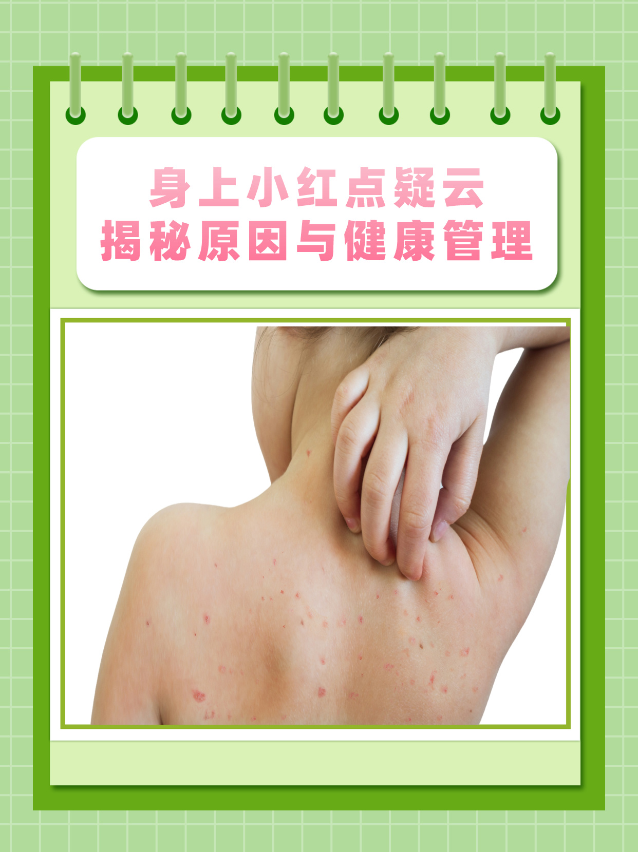 身上长红点是什么病