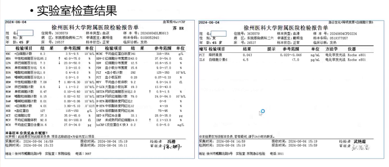 eb病毒阳性严重吗