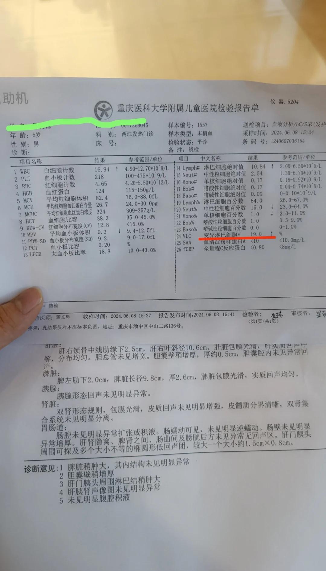 eb病毒阳性严重吗