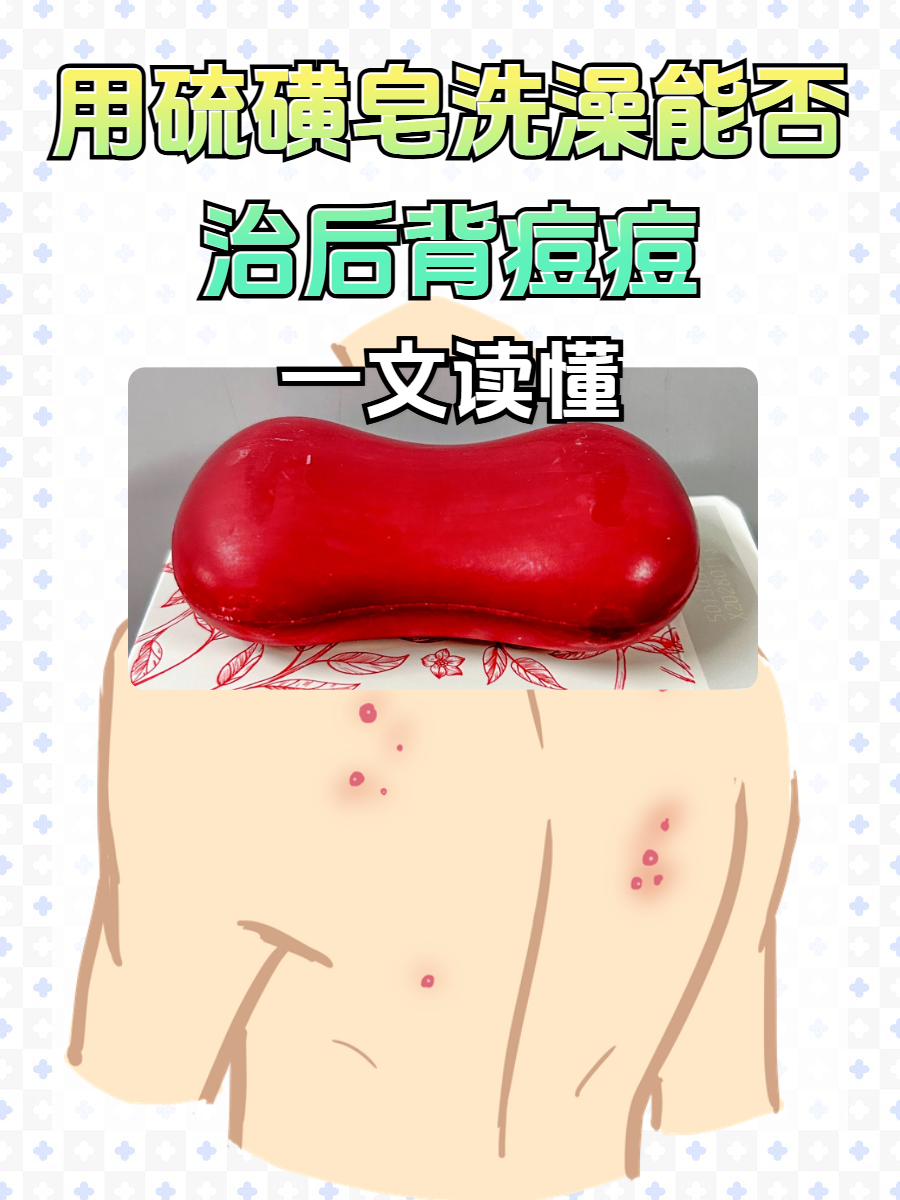 身上长了好多痘痘怎么办