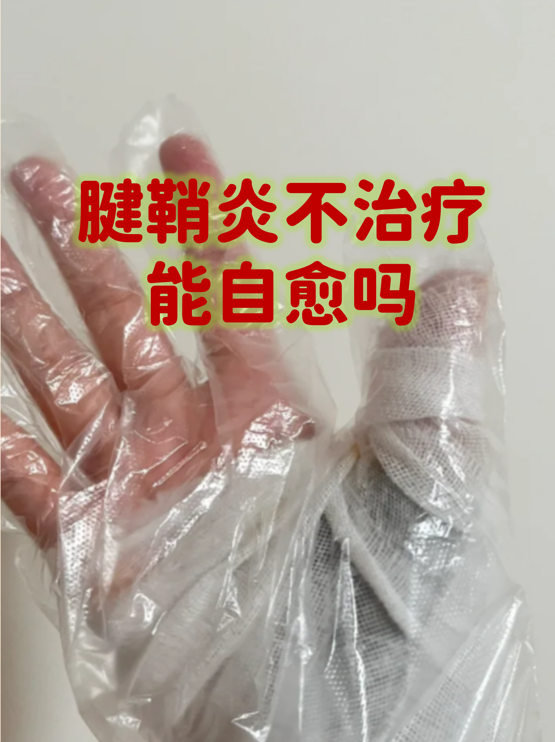 腱鞘炎能治愈吗