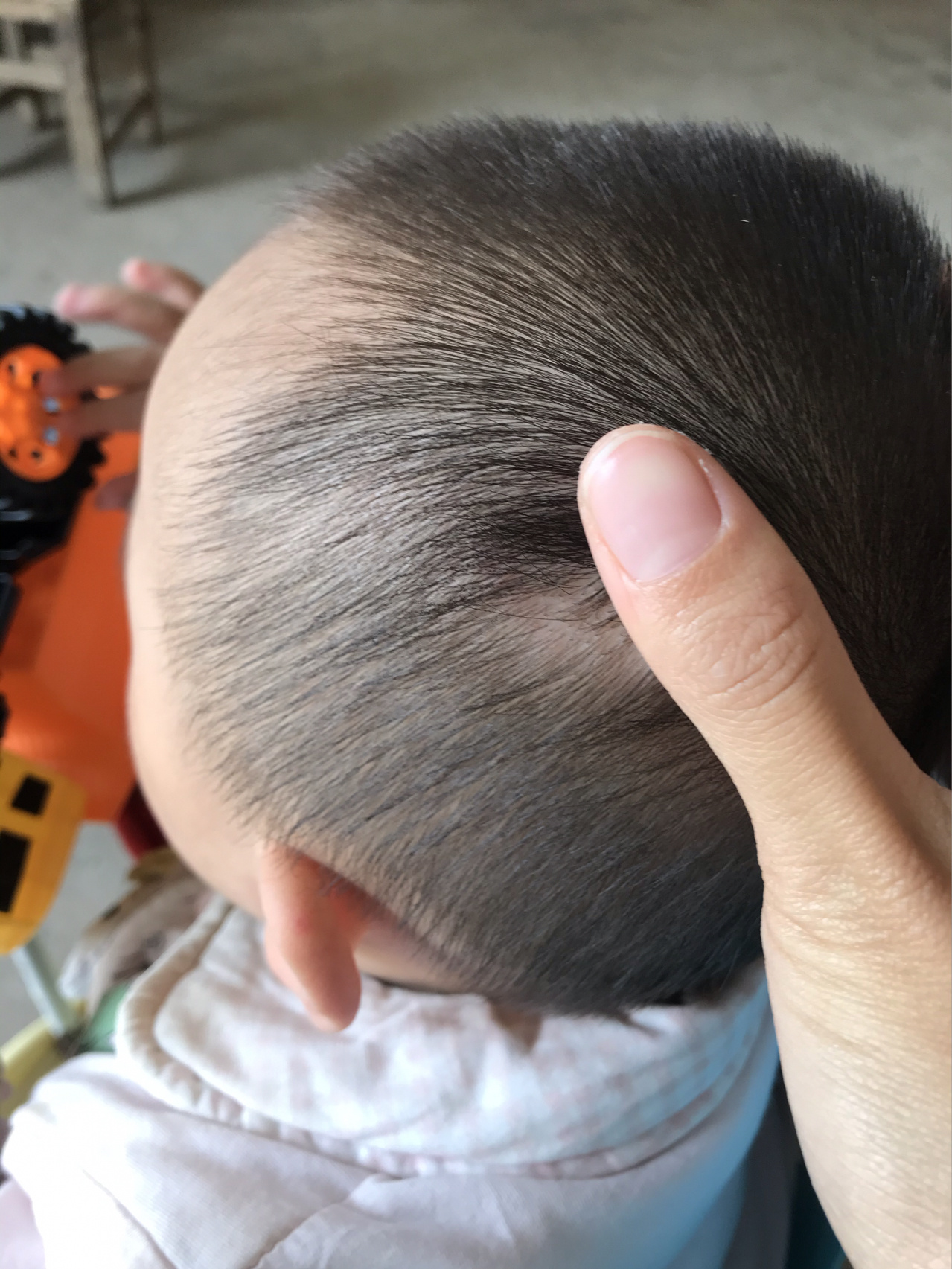 头上长了个硬包,按压很疼