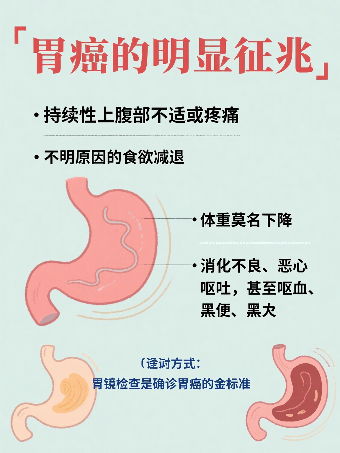 贲门癌早期症状有哪些?