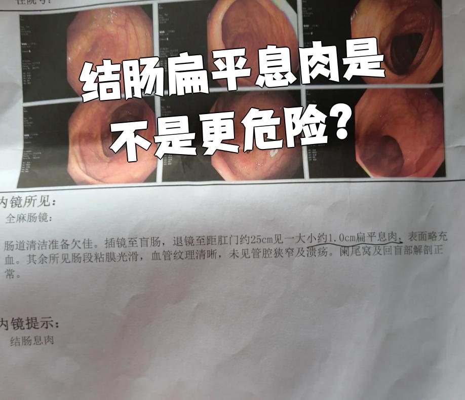 肠息肉有哪些症状?