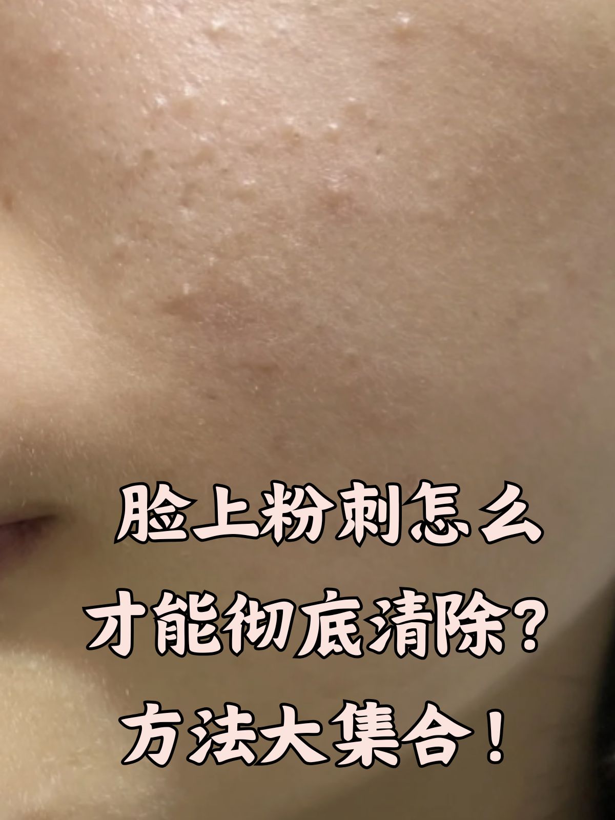 油性皮肤怎么根治