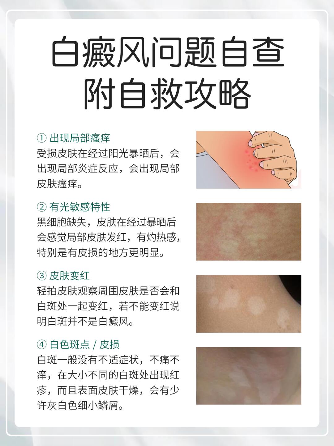 白斑是什么原因造成的?