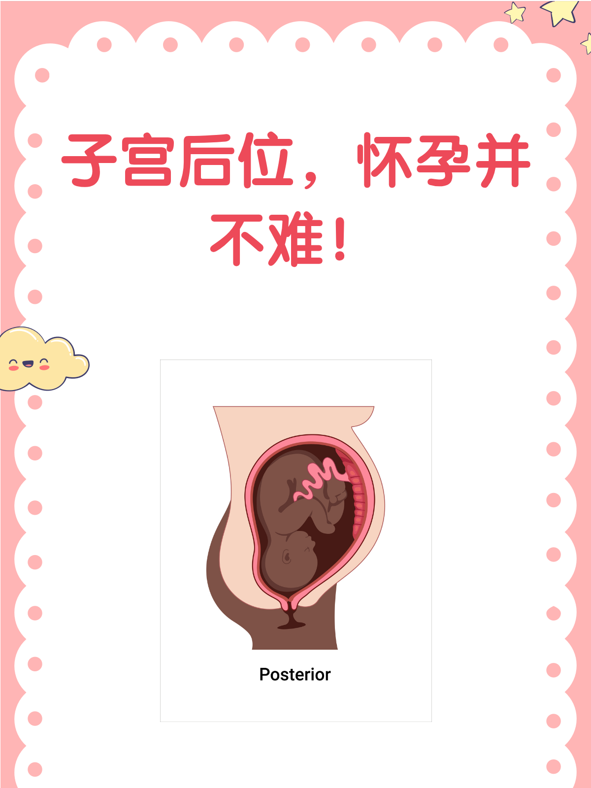 子宫后位会腰痛吗