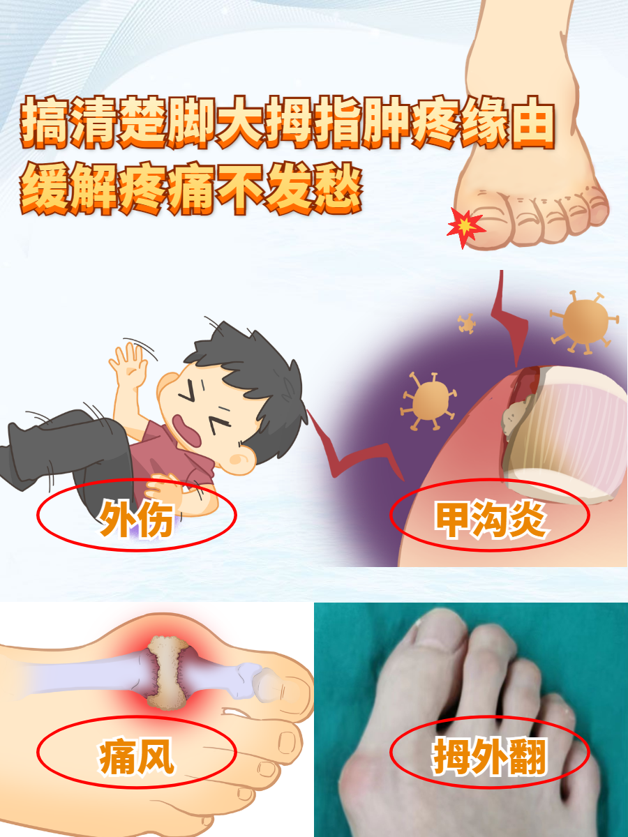 导致脚肿的原因有哪些